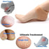 Purastep Silicone Gel Heel Pad Socks for Pain Relief - 1 Pair