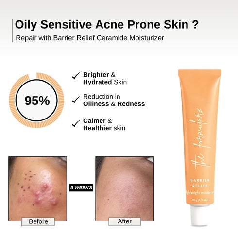 The Formularx Barrier Relief Ceramide Lightweight Moisturizer