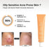 The Formularx Barrier Relief Ceramide Lightweight Moisturizer