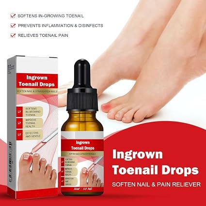 Ruesy Ingrown Toenail Softening And Care Drops Nail Softener And Foot Hygiene Solution