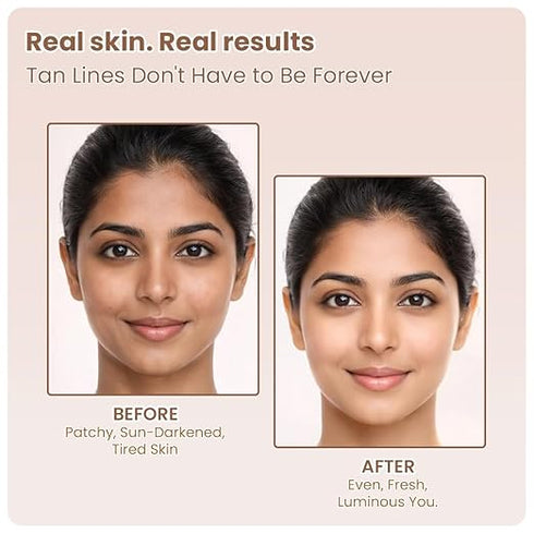 TNW The Natural Wash DeTan Tan Removal Face Pack
