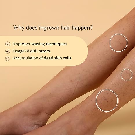 Carmesi Ingrown Relief Body Serum