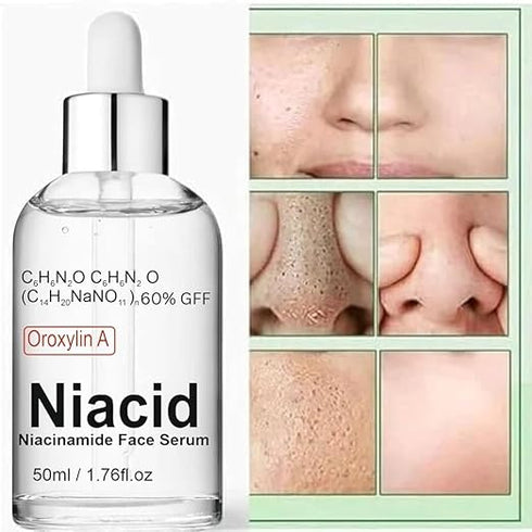 Niacid Skin Refining Serum – Controls Oil & Helps Reduce Acne Marks 30ml