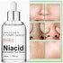 Niacid Skin Refining Serum – Controls Oil & Helps Reduce Acne Marks 30ml