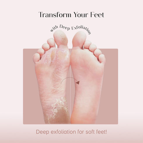 SeoulSkin Glycolic Acid Foot Peeling Mask