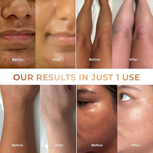 Niconi Tan Vanish Gluta-Kojic Skin Polish 180ml