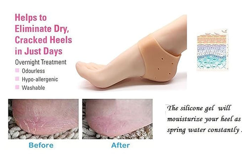 Purastep Silicone Gel Heel Pad Socks for Pain Relief - 1 Pair