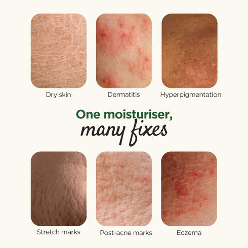 Elovera Moisturising Cream 75g