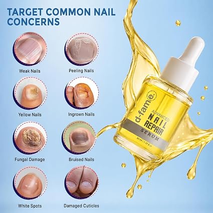 D-fame Advanced Nail Repair Serum With Nail Growth And Anti-Fungal Formula