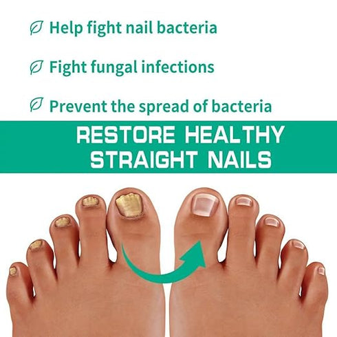 Zeropathy Nail Growth|Strengthening Oil