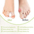 K.K. Villa Toe Separators Bunion Corrector Relief For Men