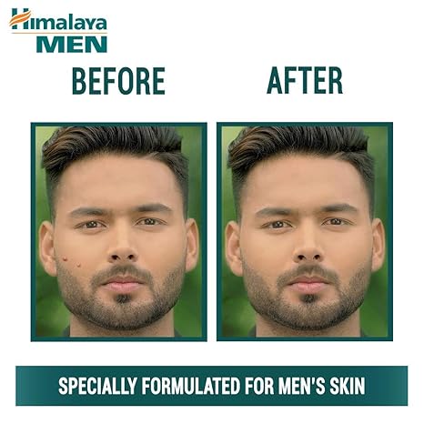 Himalaya Men Pimple Clear Neem Face Wash