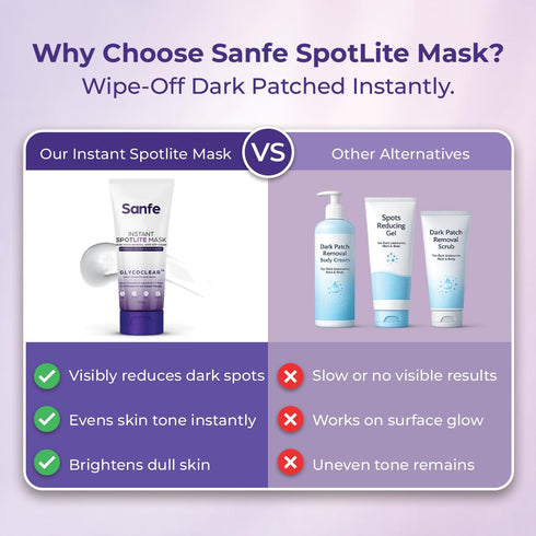 Sanfe Instant Spotlite Mask 100g | Dark Patch Removal for Underarms, Neck & Body
