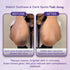 Sanfe Instant Spotlite Mask 100g | Dark Patch Removal for Underarms, Neck & Body