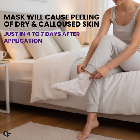Carbamide Forte Peeling | Exfoliating Foot Peel off Mask