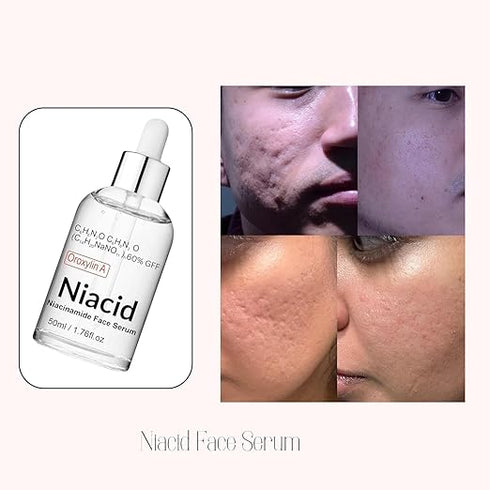 Niacid Skin Refining Serum – Controls Oil & Helps Reduce Acne Marks 30ml