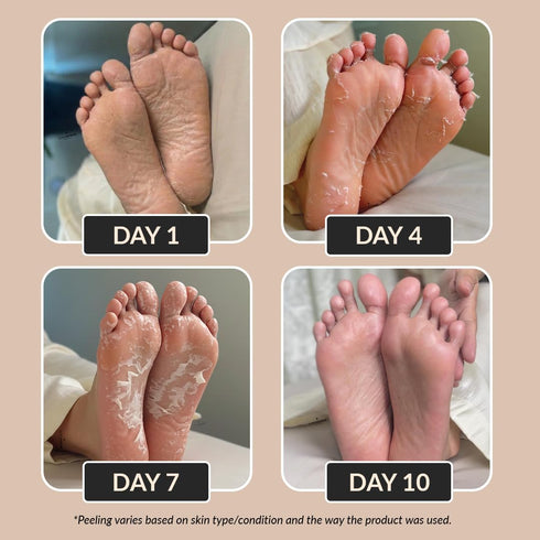 LuxaDerme Peeling | Exfoliating Foot Mask