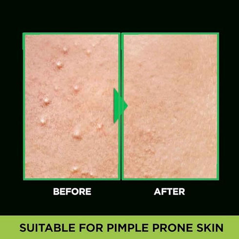 Garnier Men Acno Fight 6-in-1 Anti-Pimple Face wash