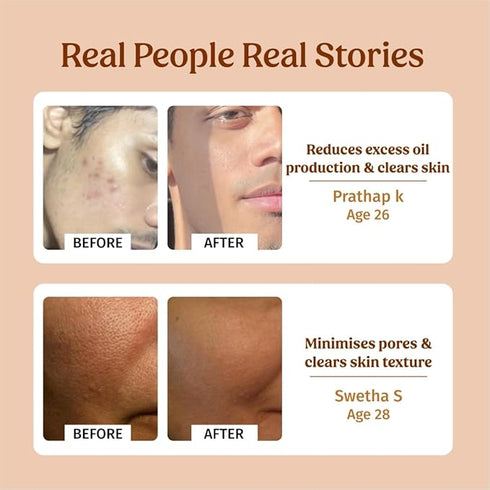 Vilvah Store Milk Face Toner