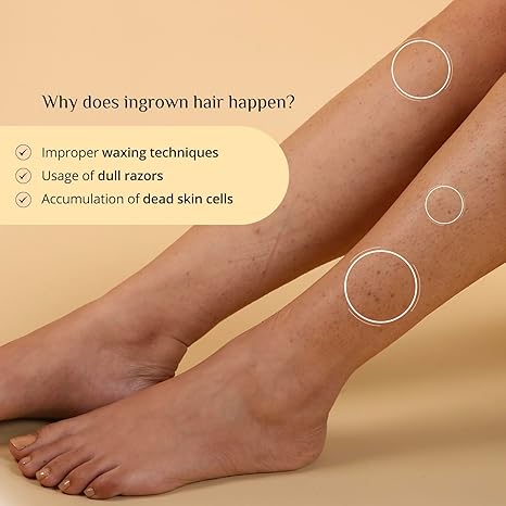 Carmesi Ingrown Relief Body Scrub