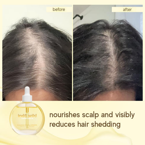 Indē wild Champi Hair Oil With Rosemary Oil