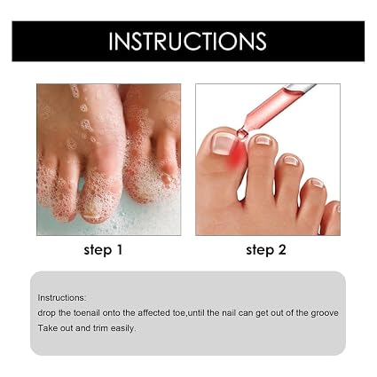 Ruesy Ingrown Toenail Softening And Care Drops Nail Softener And Foot Hygiene Solution