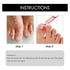 Ruesy Ingrown Toenail Softening And Care Drops Nail Softener And Foot Hygiene Solution