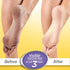 Krack Cream Heel Repair 25 gm