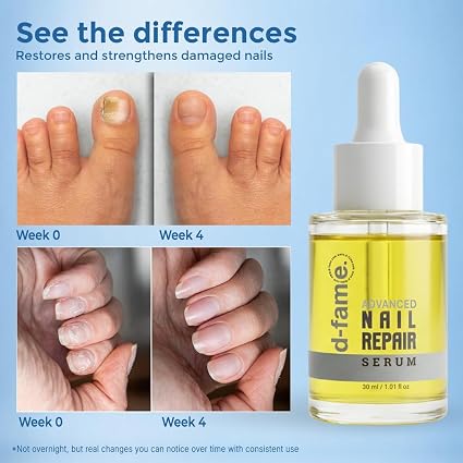 D-fame Advanced Nail Repair Serum With Nail Growth And Anti-Fungal Formula