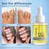 D-fame Advanced Nail Repair Serum With Nail Growth And Anti-Fungal Formula