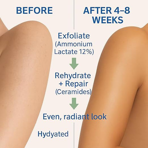 Lacderm Moisturize Lacsoft Lotion 150Ml