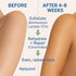 Lacderm Moisturize Lacsoft Lotion 150Ml
