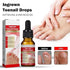 Ruesy Ingrown Toenail Softening And Care Drops Nail Softener And Foot Hygiene Solution