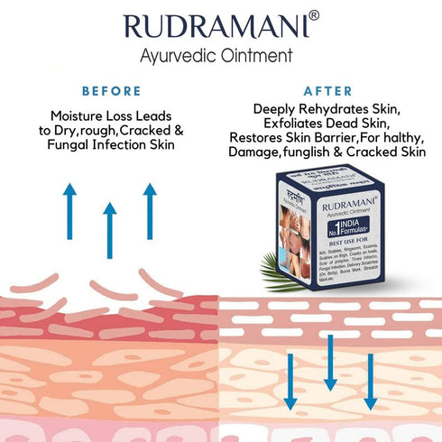 RUDRAMANI Auyrvedic Malam Cream