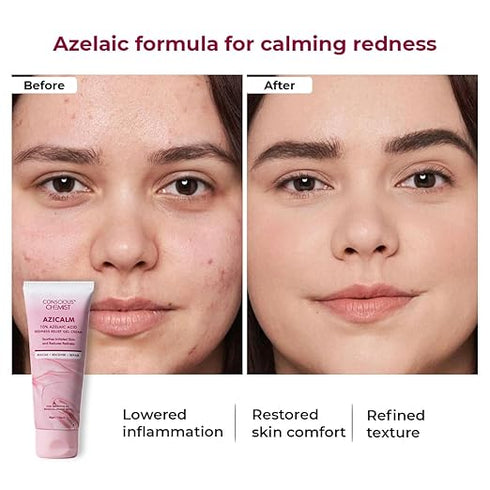 Conscious Chemist® 10% Azelaic Acid Cream | 50g