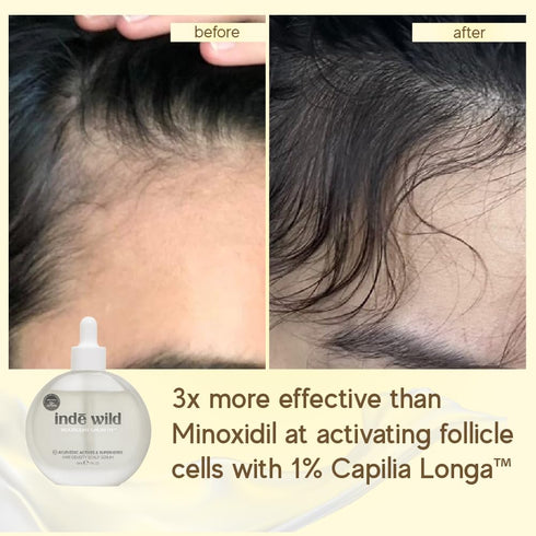 Indē wild Moonlight Overnight Scalp Serum