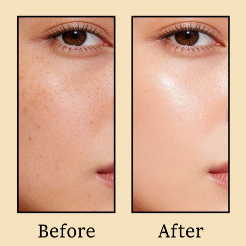 Karrot Skin Tightening Range