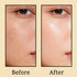 Karrot Skin Tightening Range