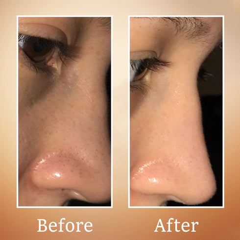 Karrot Brightening Face Toner