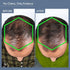 Thriveco Men's Hair Growth Supplement 60N Capsules