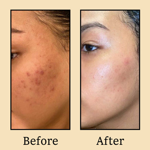 Karrot Coffee Face Pack