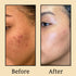 Karrot Coffee Face Pack