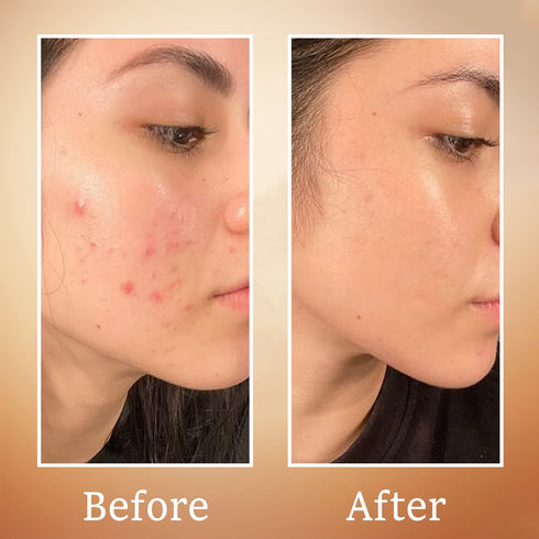 Karrot Green Tea Face Toner