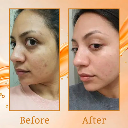 Karrot Skin Tightening Range