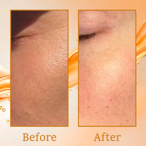 Karrot Skin Tightening Range