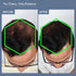 Thriveco Hair Growth Serum 50ml Men's DHT Blocker Supplement 30N