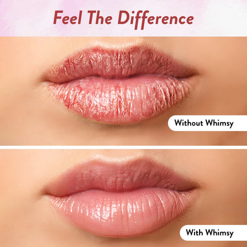 Whimsy Beauty Nature - Lip Balm