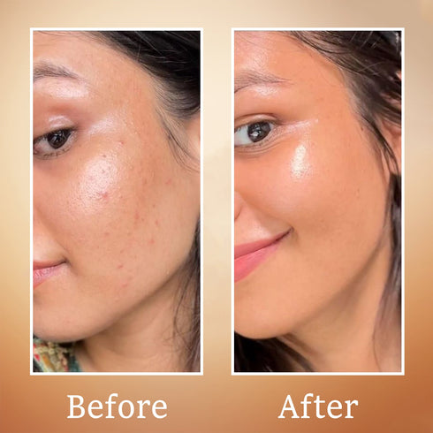 Karrot Vitamin C Face Toner