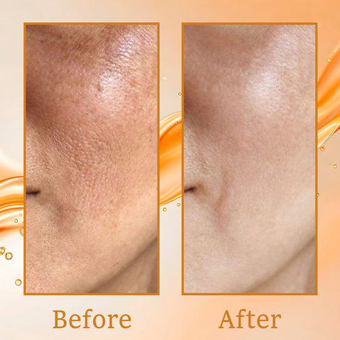 Karrot Retinol Anti Aging Serum