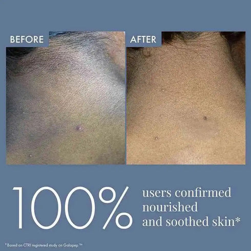 Thriveco Dark Patches Corrector for Men & Women